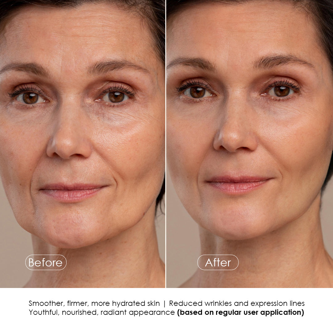 Age+ Dead Sea Anti-Aging Night Cream with Collagen, Hyaluronic Acid & Lactomide Lifting Complex