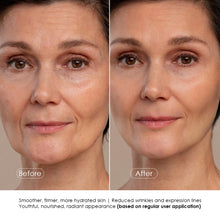 Age+ Dead Sea Anti-Aging Night Cream with Collagen, Hyaluronic Acid & Lactomide Lifting Complex